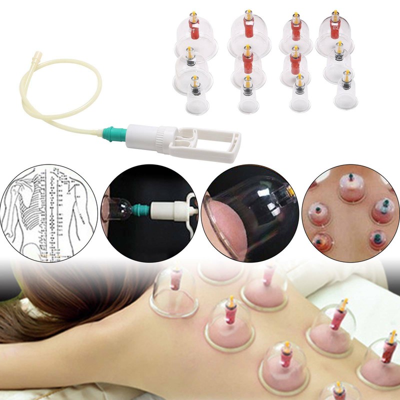 Schröpfen Set Mit 12 Schröpfgläser aus Kunststoff Schröpfen Set Vakuum Massage