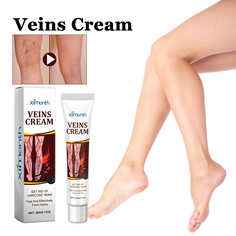 CrÃ¨Me De Traitement Des Varices Jambe Vascularite PhlÃ©Botomie
