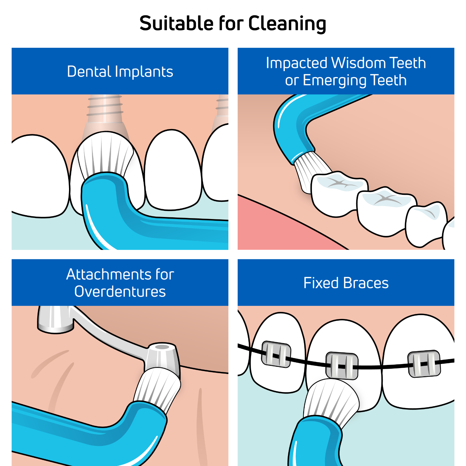 TEPE Compact Tuft Toothbrush - Braces & Hard to Reach Areas, 1 Pk