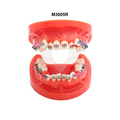 Multiple Types Dental Teaching Teeth Model Typodont Ortho Implant Practice Demo