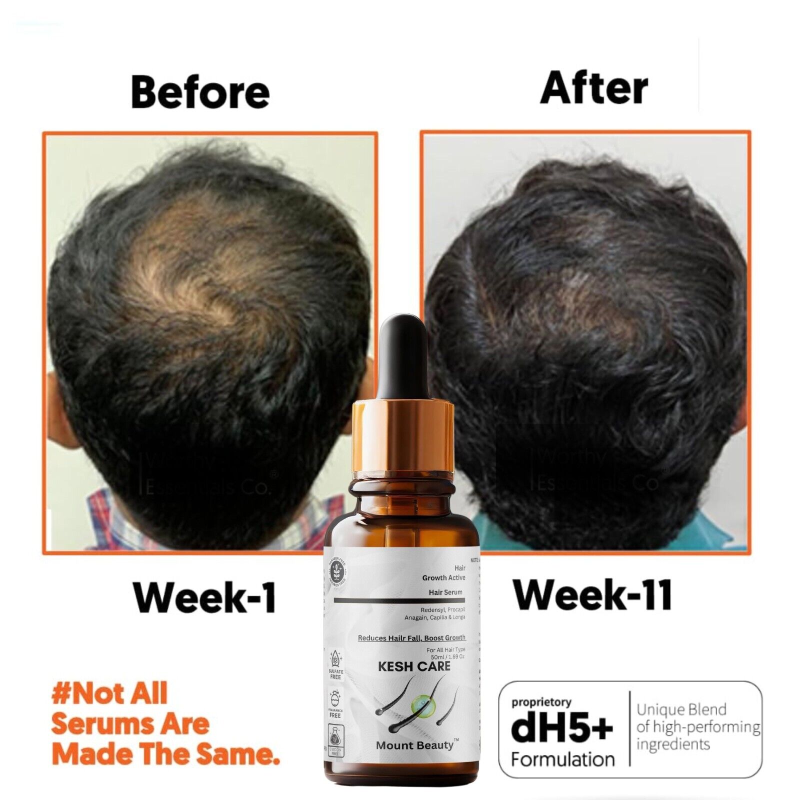 Hair Growth Serum Hair Growth Serum Designed for Thinning Hair & Hair Loss 50ml | eBay Hair Growth Serum Hair Growth Serum Designed for Thinning Hair & Hair Loss 50ml | eBay