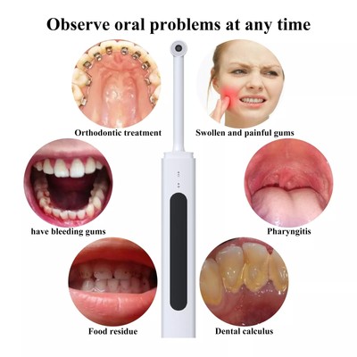 Dental USB Intraoral Camera Oral Endoscope Intra Oral Digital Imaging 1080P