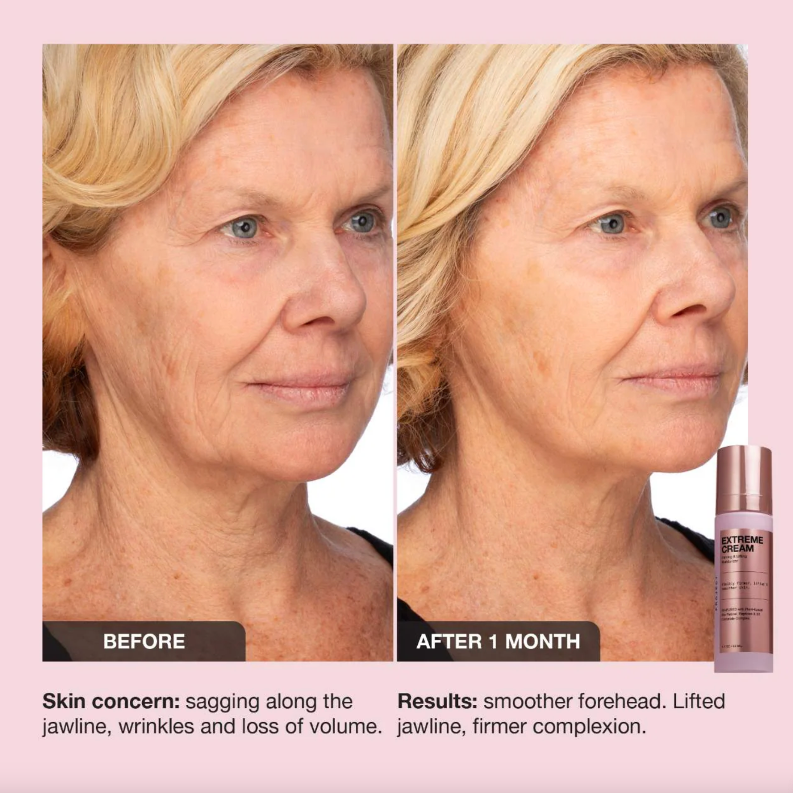 iNNBEAUTY PROJECT Extreme Cream Anti-Aging, Firming & Lifting Moisturizer 1.7 oz