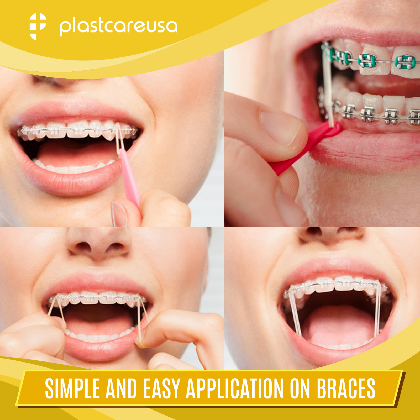 Latex Elastics Rubber Bands Orthodontic Dental Braces Teeth - Light Medium Heavy