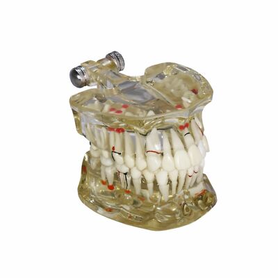 Redland  Dental Demonstration Teeth Educational Model And Sales - FDA