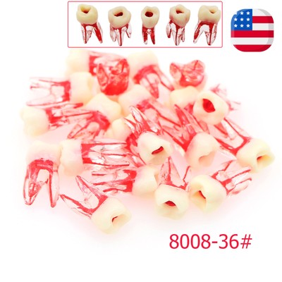 US 10PCS RCT/MTA #36 Endo Molar Root Canal Study Practice Block Pulp Cavity Mode
