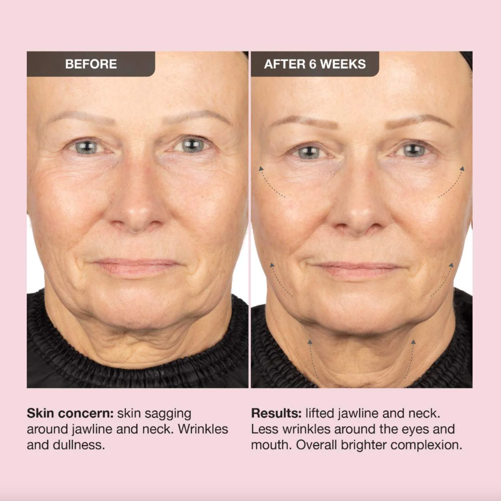 iNNBEAUTY PROJECT Extreme Cream Anti-Aging, Firming & Lifting Moisturizer 1.7 oz