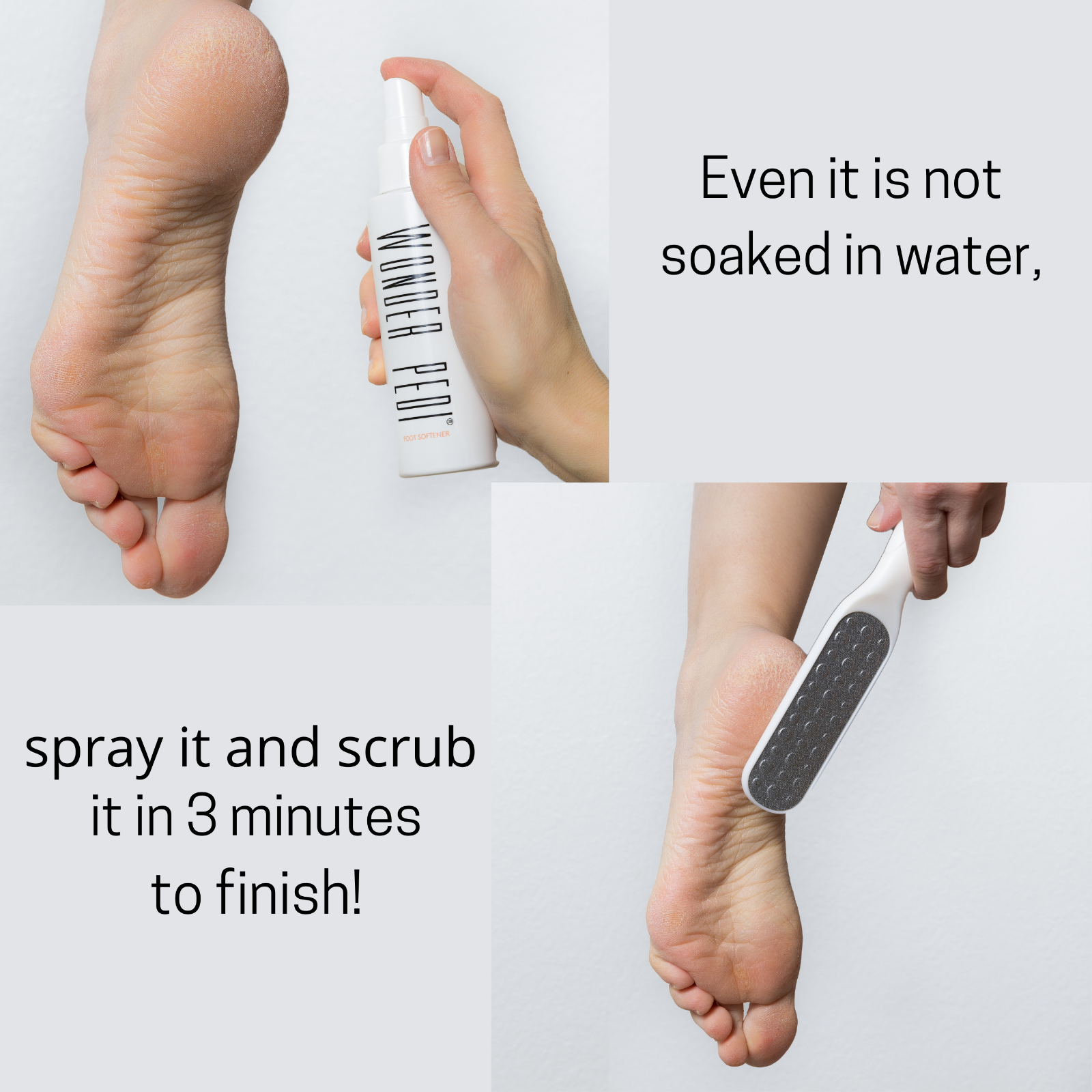 Callus Remover Quick Fix Foot File Rasp + Instant Exfoliating Softener Spray