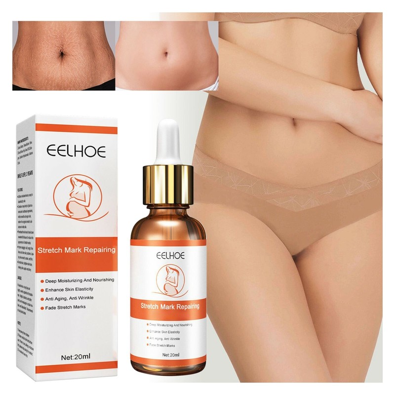 Scar Cream Stretch Mark Removal