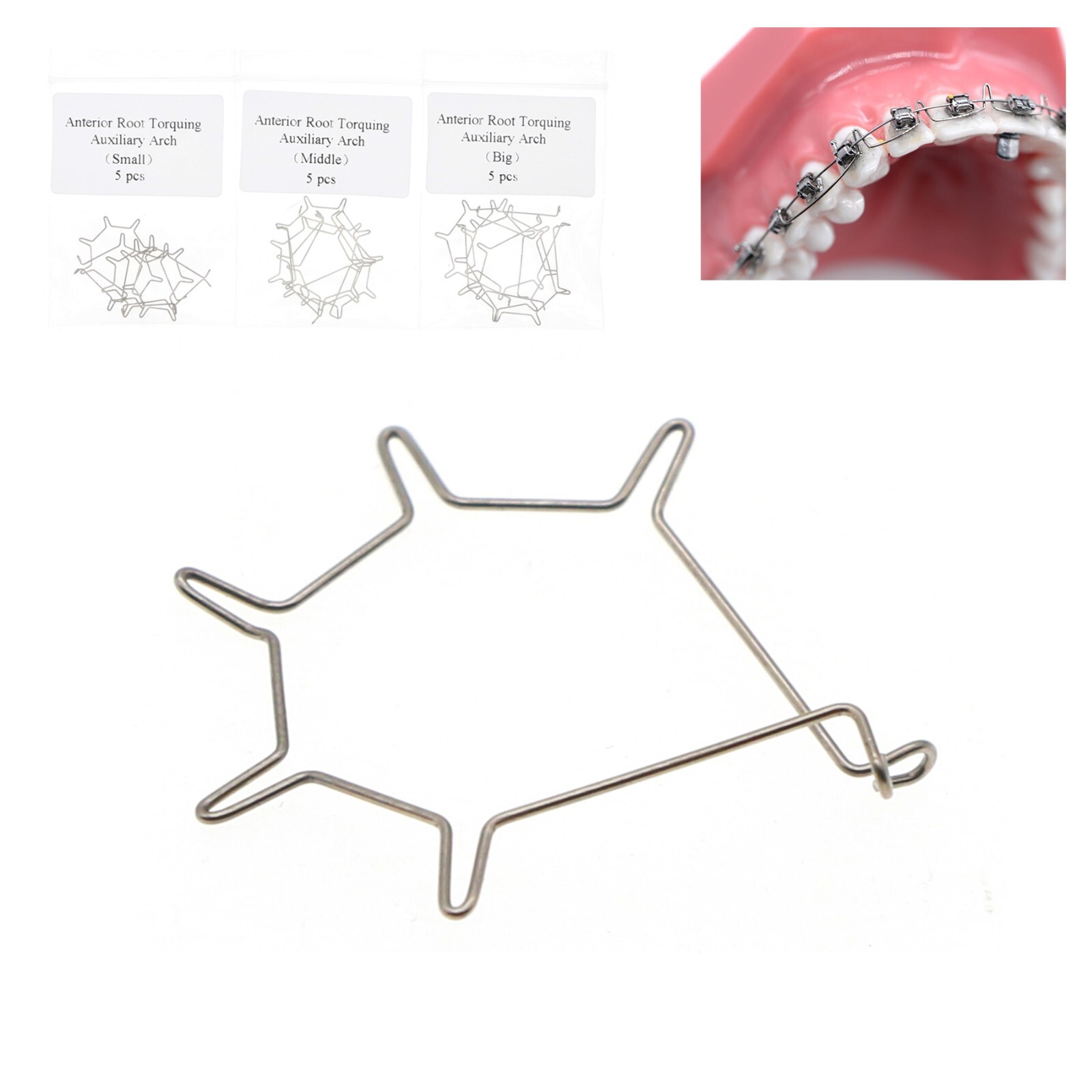 ✴arks✴ Dental Orthodontic Anterior Root Torquing Auxiliary Arch Big