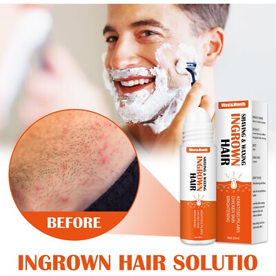 Razor Bumps Solution After Shave for Ingrowns and Burns, Dark Spot Corrector