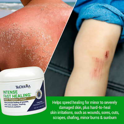 TriDerma Intense Fast Healing Multipurpose Cream Jar, Pack of 4