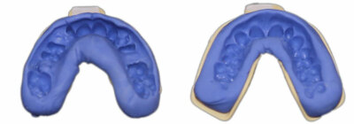 Premium Dental Retainer ~Custom Fitted ~Made by USA Dental Lab