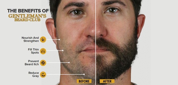 Gentlemen's Beard Club FACIAL HAIR GROWTH formula 60 ct capsules ITCH RELIEF