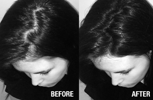 Nanogen Keratin Hair Building Fibers Concealer 15 Grams/0.53 Oz, Package Varies