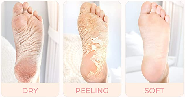 B-Pure Lavender Scented Foot Mask/Ultra Moisturizing/Nourishing/Softening 1 Pair