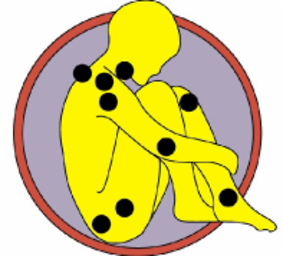 Fibromyalgia Support N. Ireland