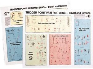 Trigger Point Charts For Sale