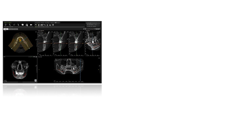 CBCT Cone Beam Dental CT Genoray Volux