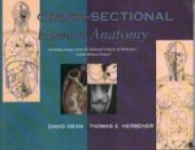 Cross-Sectional Human Anatomy by Herbener, Thomas E. Hardback Book The Fast Free