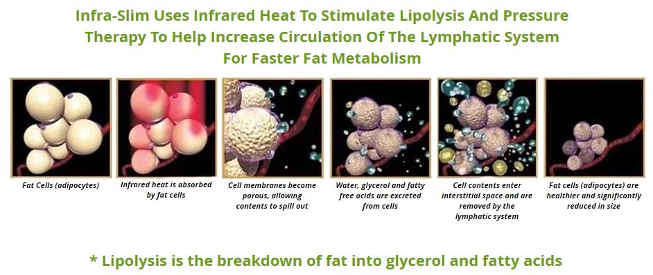 Infra-Slim Body Contouring System / Suit (pressotherapy ; infrared pressure)