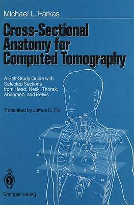 Cross-Sectional Anatomy for Computed Tomography - 9781461387848