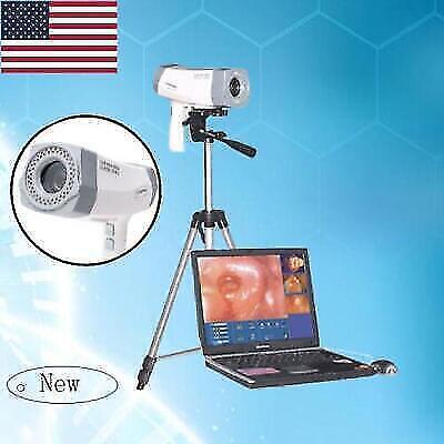 Carejoy 800K pixels Digital Electronic Colposcopy SONY Image Vaginal Camera