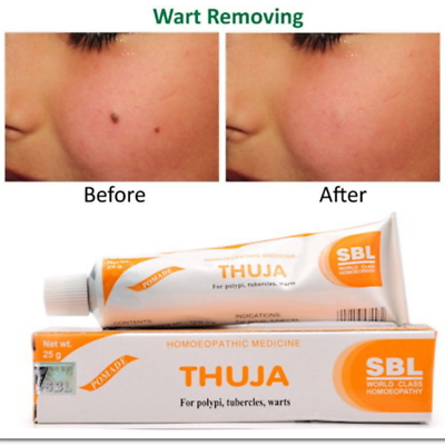 10 X Thuja Homeopathic Wart Mole Tag Remover Herbal Cream Corn Removal 25g