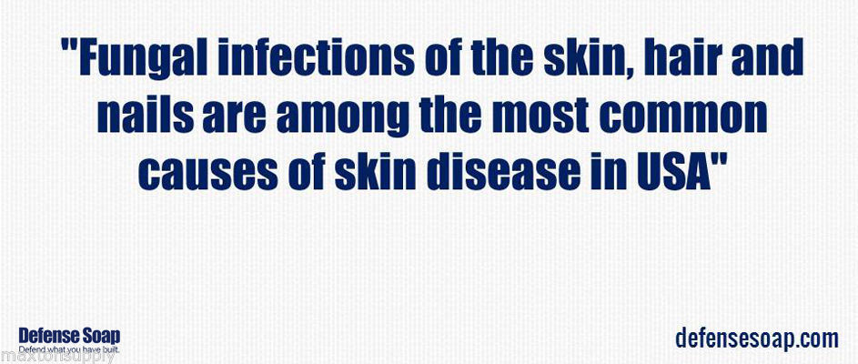 DEFENSE SOAP Shower Gel PEPPERMINT 8 Fl Oz Natural Body Wash Tea Tree Oil