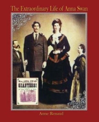 The Extraordinary Life Of Anna Swan