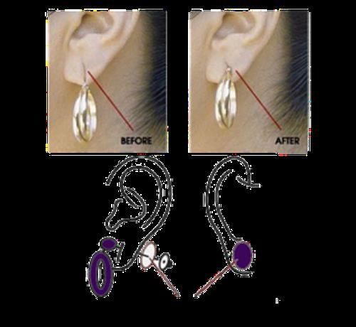 Lobe Miracle Ear Lobe Support Patches 60 Count, ear lobe support