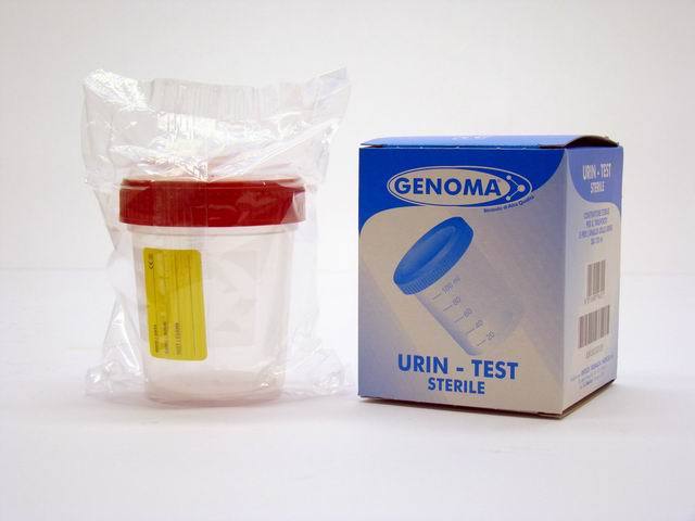 Contenitore Sterile Per Analisi Urine 150ml moc