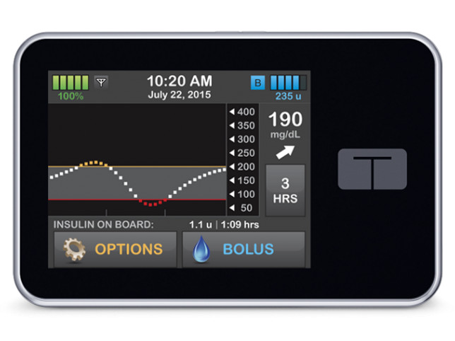 Pompe Ã  Insuline T:Slim X2