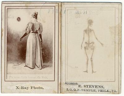 X-Ray photo,Ein neues Licht legwet die Welt,2 views of woman,skeletal,1896