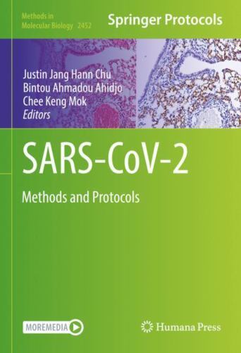 Methods in Molecular Biology Ser.: SARS-CoV-2 : Methods and Protocols ...