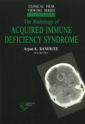Arpan K Banerjee Radiology of Acquired Immune Deficiency Syndrome (Tapa blanda)