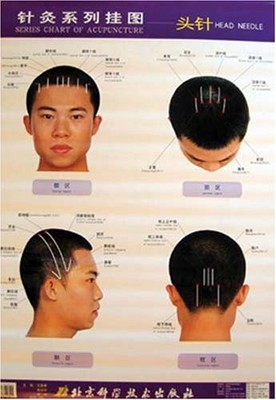 SERIES CHART OF ACUPUNCTURE: HEAD NEEDLE (ENGLISH AND By Wang Fuchun *BRAND NEW*