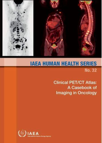 Clinical Pet/Ct Atlas: a Casebook of Imaging in Oncology : IAEA Human ...