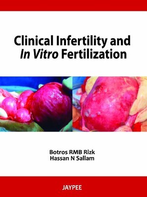 CLINICAL INFERTILITY AND IN VITRO FERTILIZATION By Botros R. M. B. Rizk & Hassan