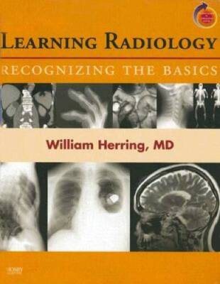 Learning Radiology: Recognizing the Basics (With STUDENT CONSULT Online A - GOOD