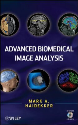 Advanced Biomedical Image Analysis, Haidekker, A. 9780470624586 Free Shipping-,