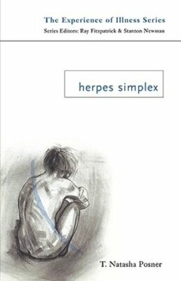 Herpes Simplex by T Natasha Posner: New