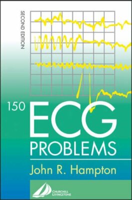 150 ECG Problems by Hampton Dr., Jo Paperback Book The Fast Free Shipping