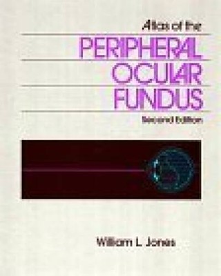 Atlas of the Peripheral Ocular Fundus - Hardcover By Jones, William L - GOOD