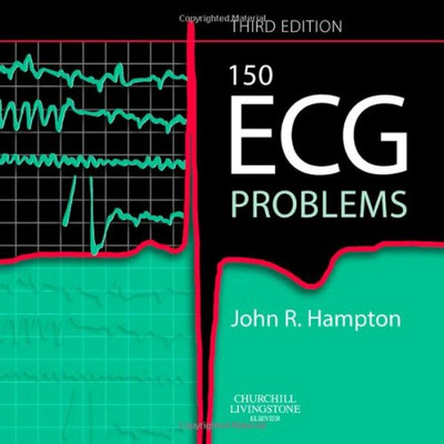 150 ECG Problems, 3e|150 Ecg Problems|150 Ecg Problems|150 Ecg Problems