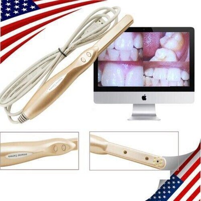 US Dental Intraoral Intra Oral Camera USB 2.0 Dynamic 4 Mega Pixels+Software