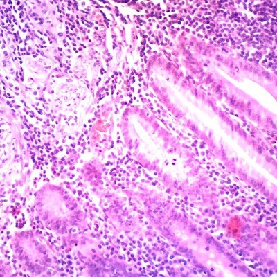 Microscope.com Omano  OMSK 50 Human Pathology Slides NIB