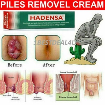 Hadensa Salbe Hämorrhoiden Trockene Haut Kratzen Reizung Haufen Remove Ergänzung