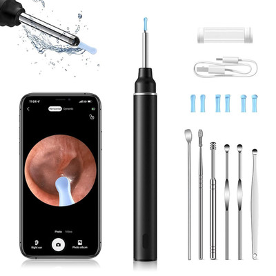 Jkevow Otoscopio Pulisci Orecchie con Telecamera,1080P 3,0mm Impermeabile... 