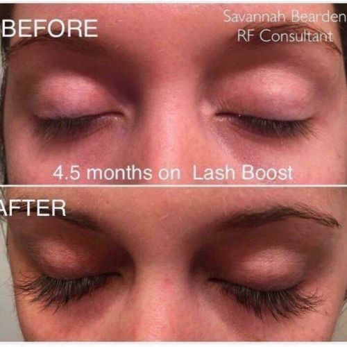 Rodan and Fields Lash Boost